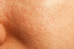 Skin Pores