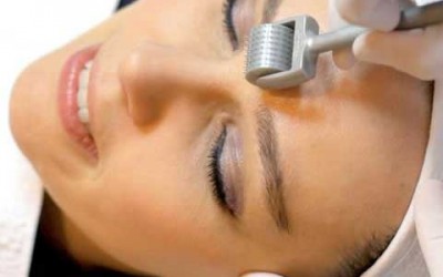 What is Dermal Needling? How can it help in Scar Removal?