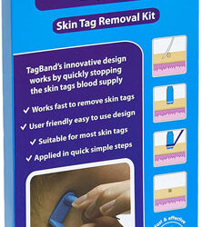 TagBand Skin Tag Removal Kit Review