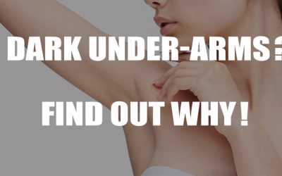 What’s Turning Your Inner Thighs and Underarms Dark?